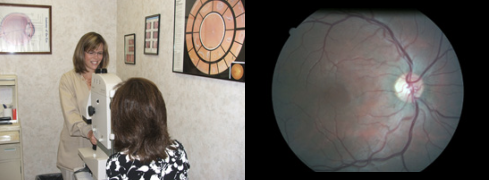 Retinal Photography Coventry & Chariho Eye Care Associates